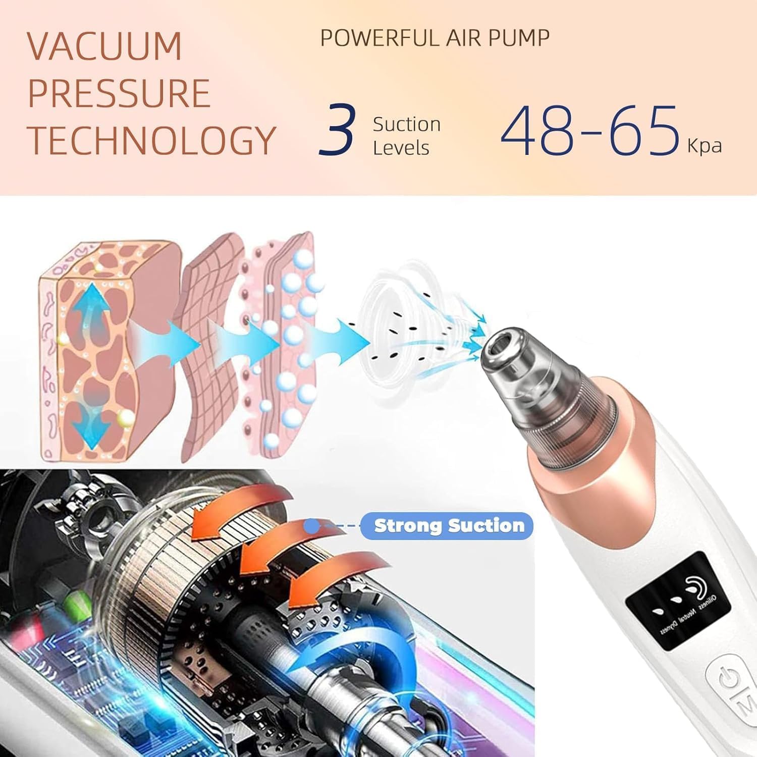 5-in-1 Blackhead Remover Machine – Electric Pore Cleaner & Whitehead Removal Tool, Deep Face Cleaner Machine for Acne, Pimple & Blackhead Removal, USB Rechargeable Derma Suction Device (Blackhead remover)